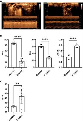 Analysis of metabolic disturbances attributable to sepsis-induced myocardial dysfunction using metabolomics and transcriptomics techniques